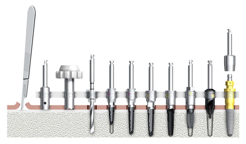 NobelReplace Tapered drill protocol.jpg