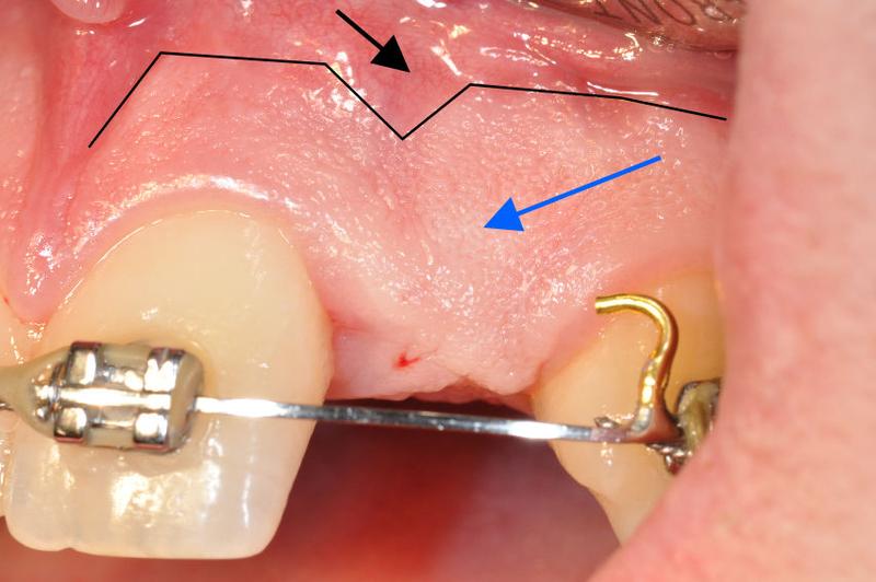 TG2 2150 Fig 1.jpg