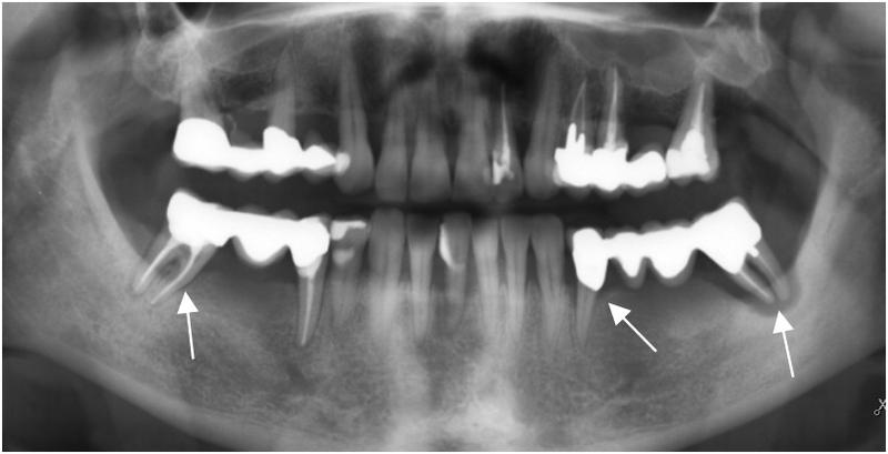 TG2_2160_Fig 3.jpg