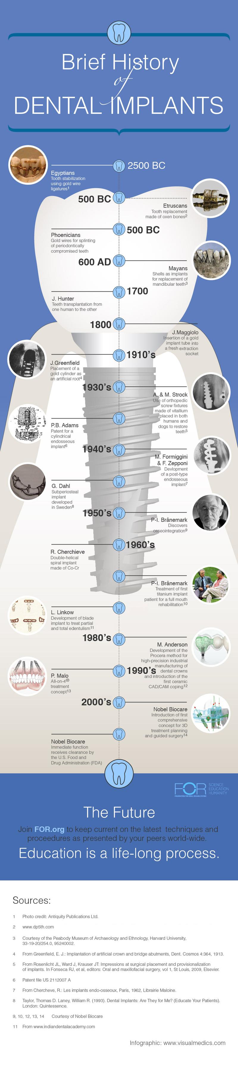 History-of-dental-implants-infographic-webII.jpg