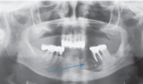 radiograph (Mobile).jpg