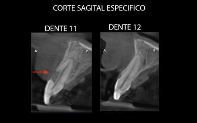 Sagittal view x-ray Pereira