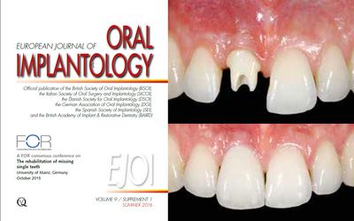 Consensus on single missing teeth