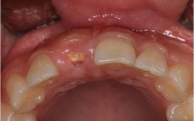 Initial situation - occlusal view.