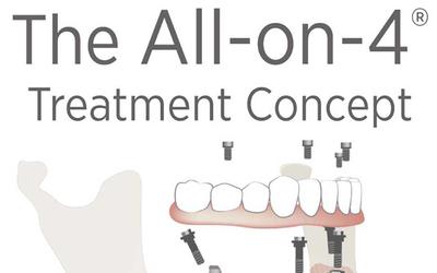 All-on-4 treatment concept