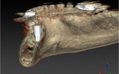 Final implant position #37 (FDI).