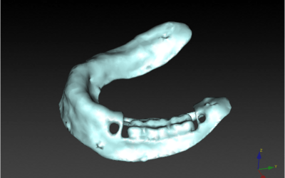 Radiographic guide.