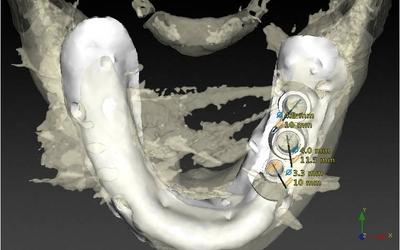 Occlusal view.