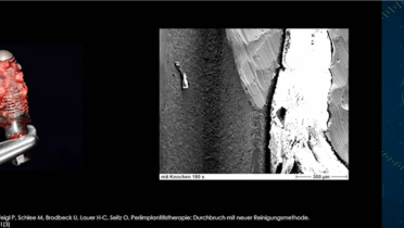 Galvosurge image