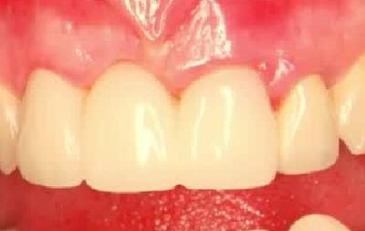 Smile line - video from FOR China Summit lecture