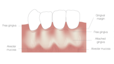 TG2_1440_Thumb_muco_gingival_junction.png