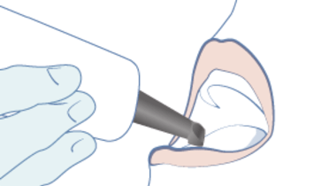 TG2_2260_thumb_Intraoral-imaging-and-Scanning.png