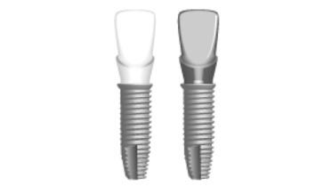 TG2_3230_thumb_Abutment-and-material-selection-copy.png