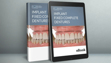 EBook: Implant Fixed Complete Dentures
